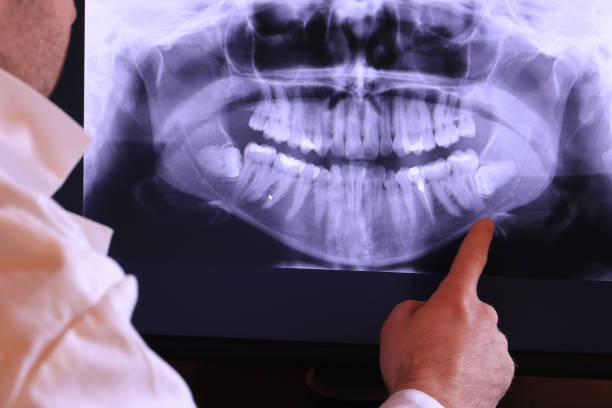 Best Emergency Denture Repair in Monteagle, TN