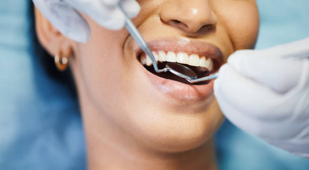 Best Emergency Dental Care for Sports Injuries in Monteagle, TN