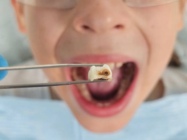 Professional Emergency Dental Service in TN